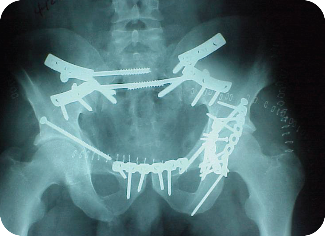 ABC of Orthopaedics and Trauma  Wiley