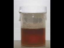 Bottle with urine in it